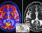 Scientists claim MRIs could diagnose gender dysphoria in ...